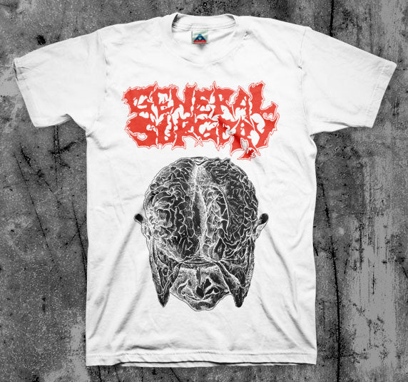 General Surgery