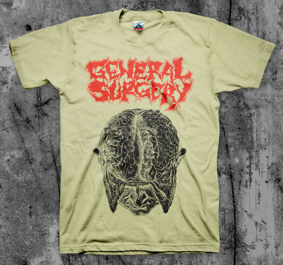 General Surgery