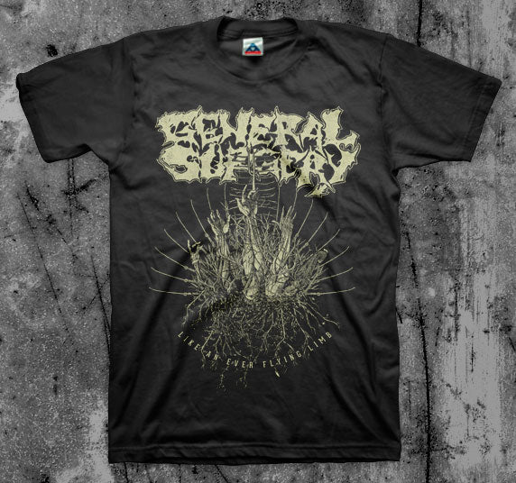 General Surgery