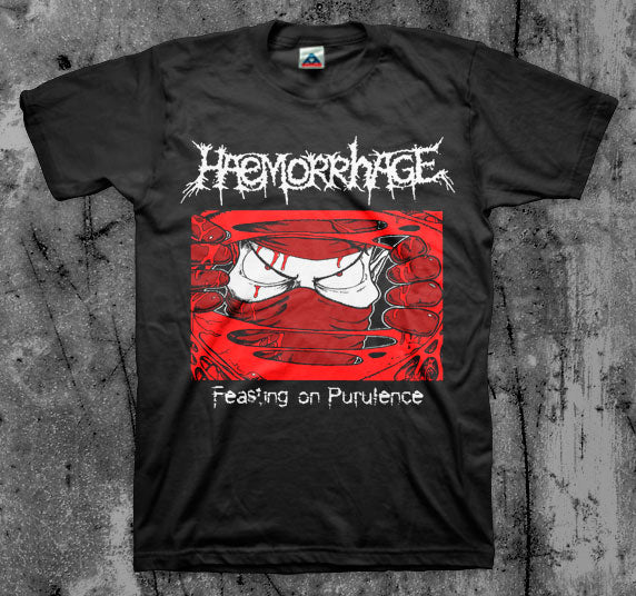 Haemorrhage