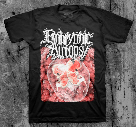 Embryonic Autopsy