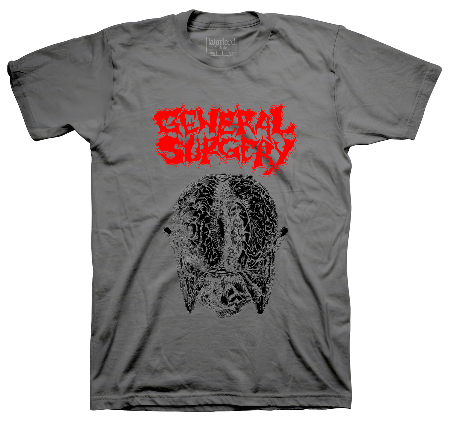 General Surgery - Charcoal