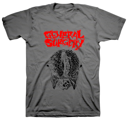 General Surgery - Charcoal
