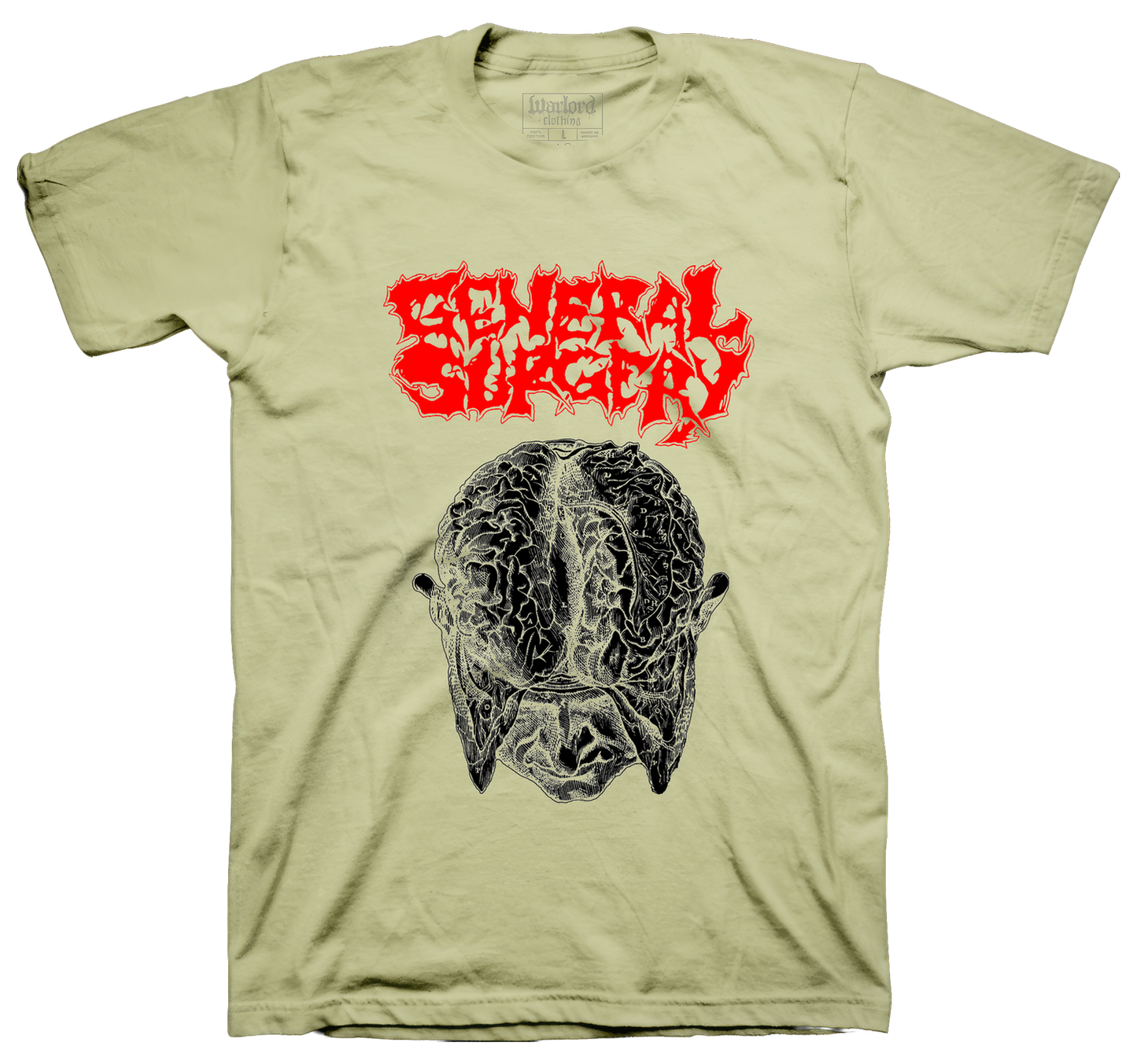General Surgery - Sand