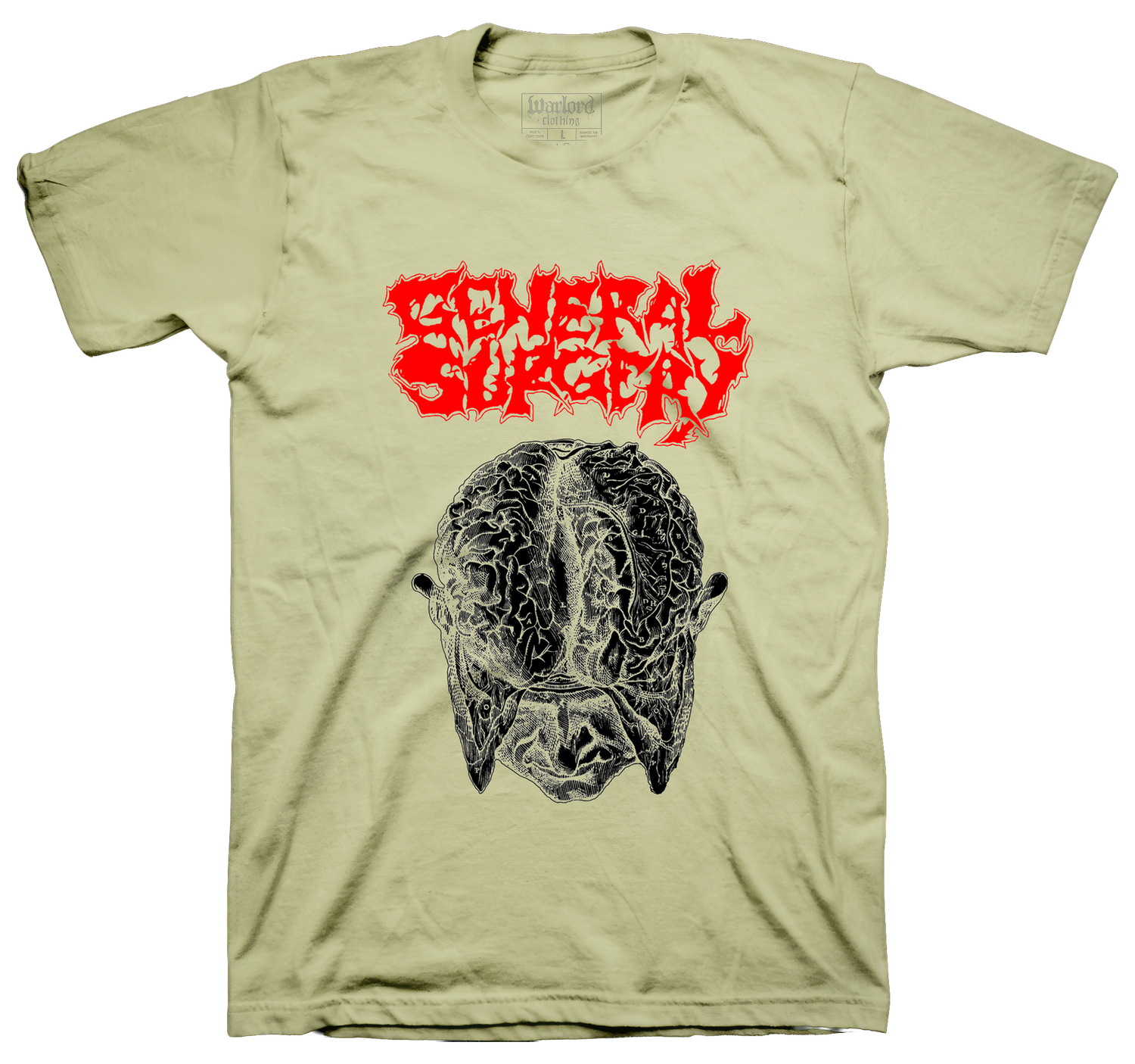 General Surgery - Sand