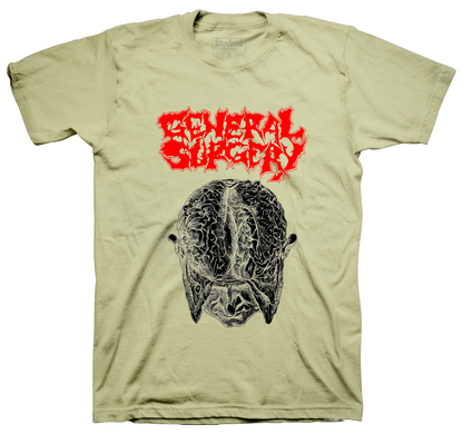 General Surgery - Sand