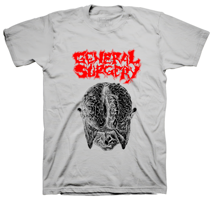 General Surgery - Silver