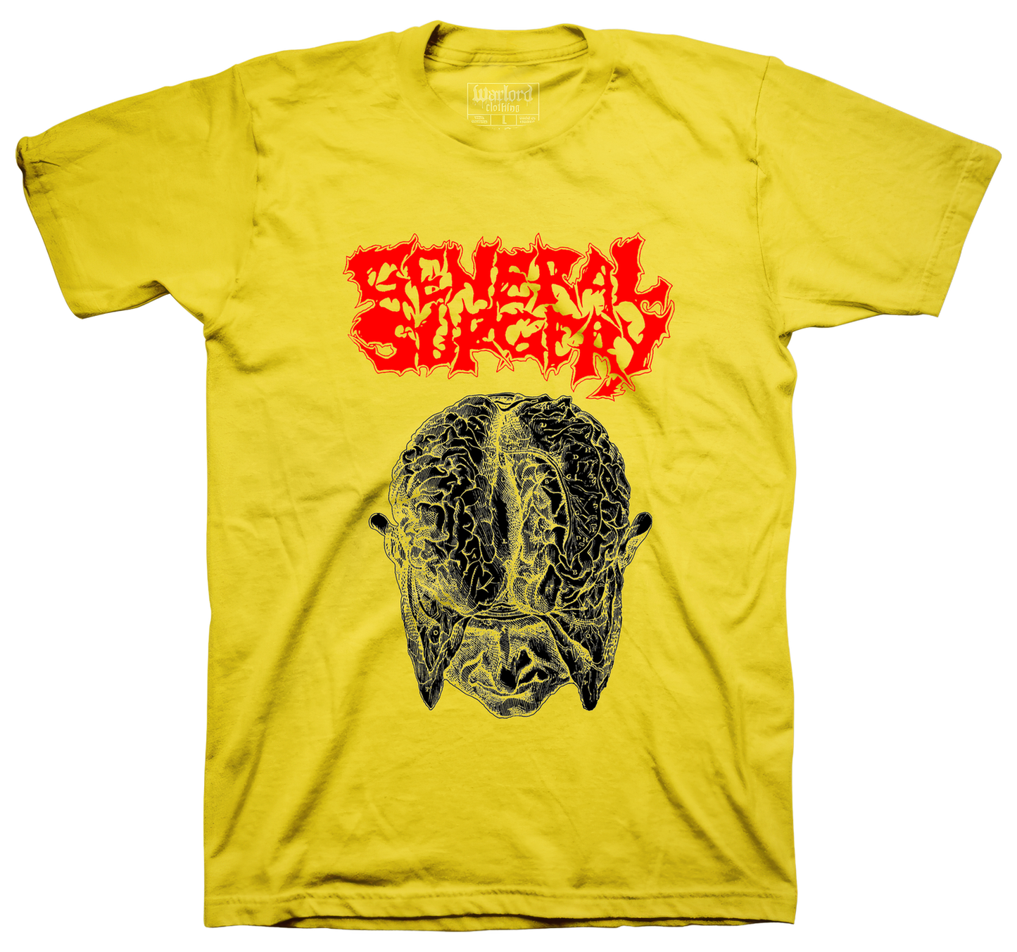 General Surgery - Yellow