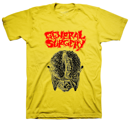 General Surgery - Yellow