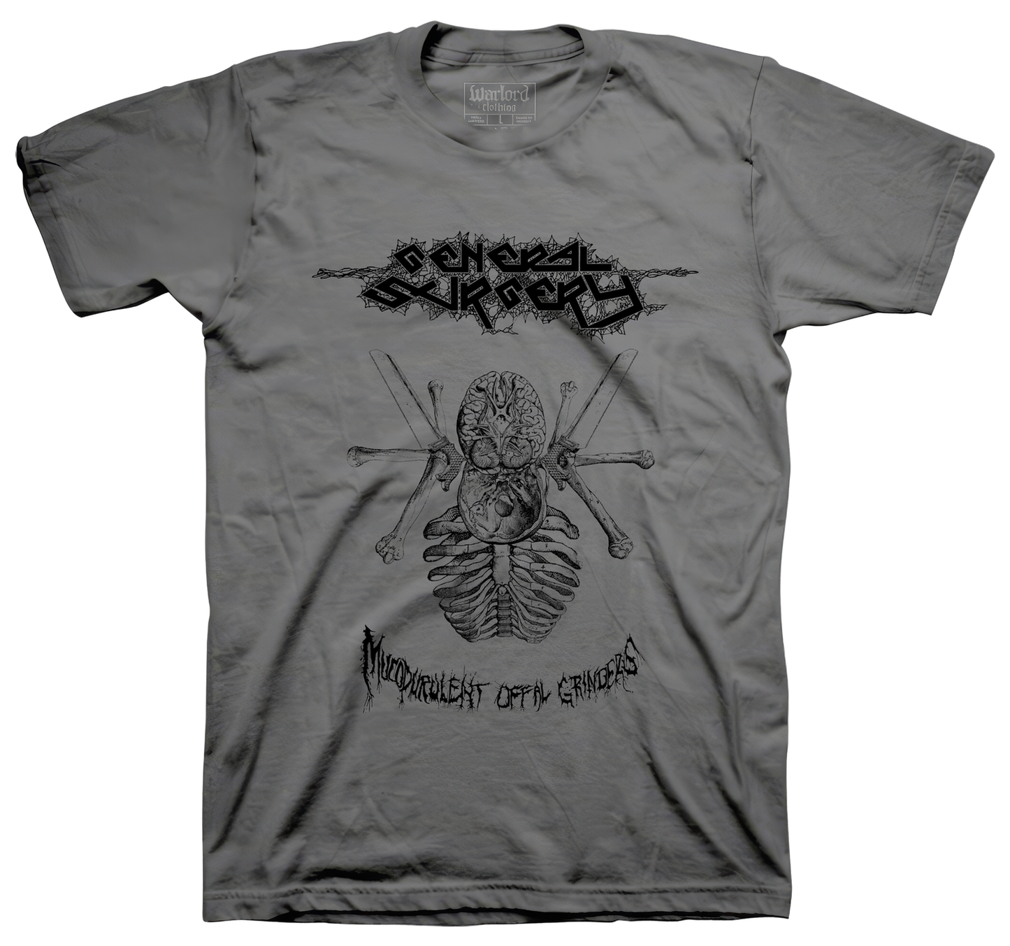 General Surgery - Charcoal