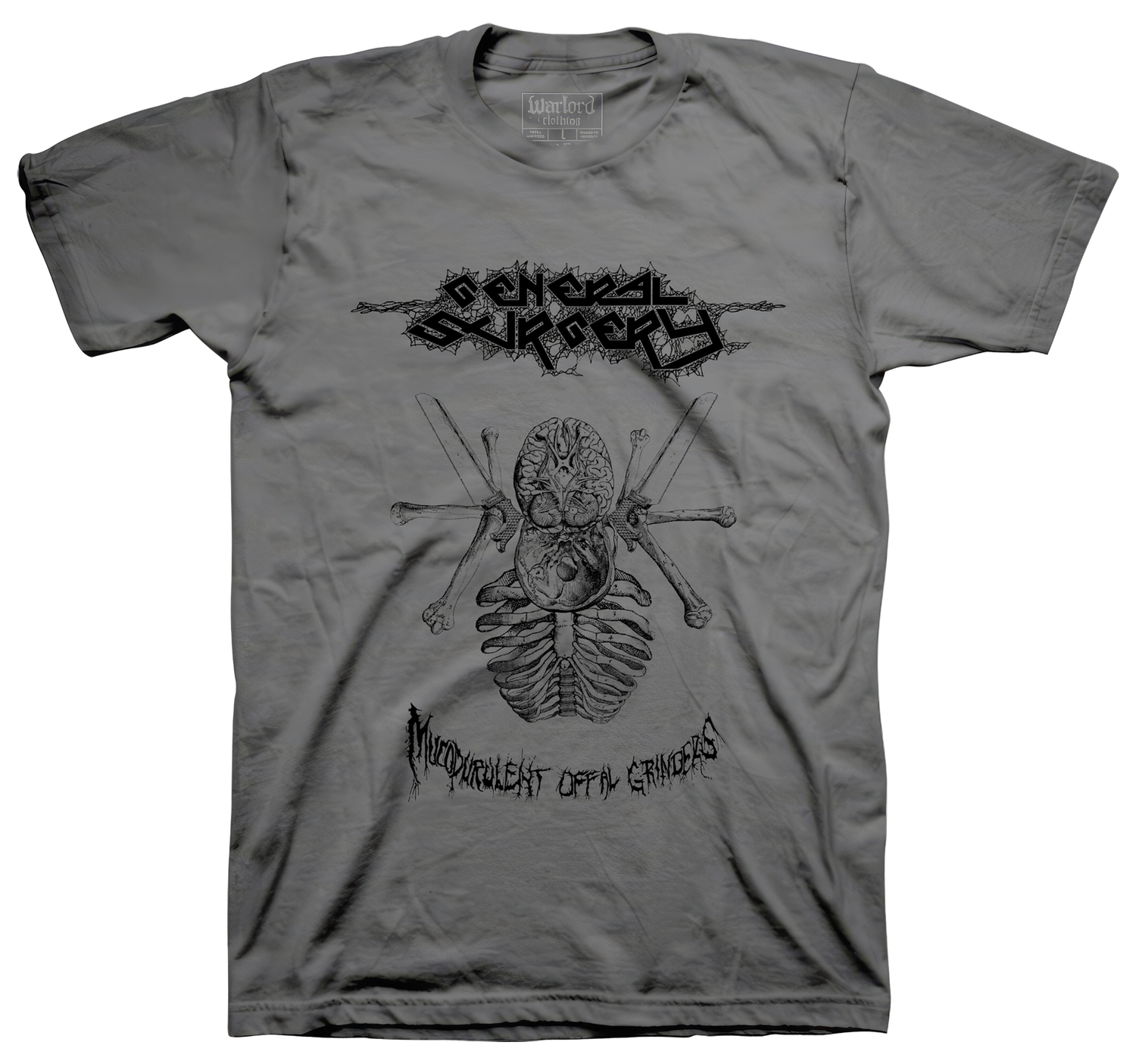 General Surgery - Charcoal