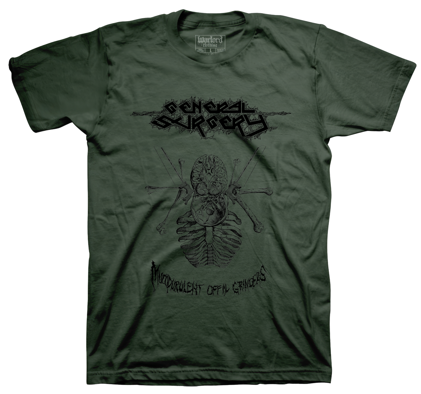 General Surgery - Olive
