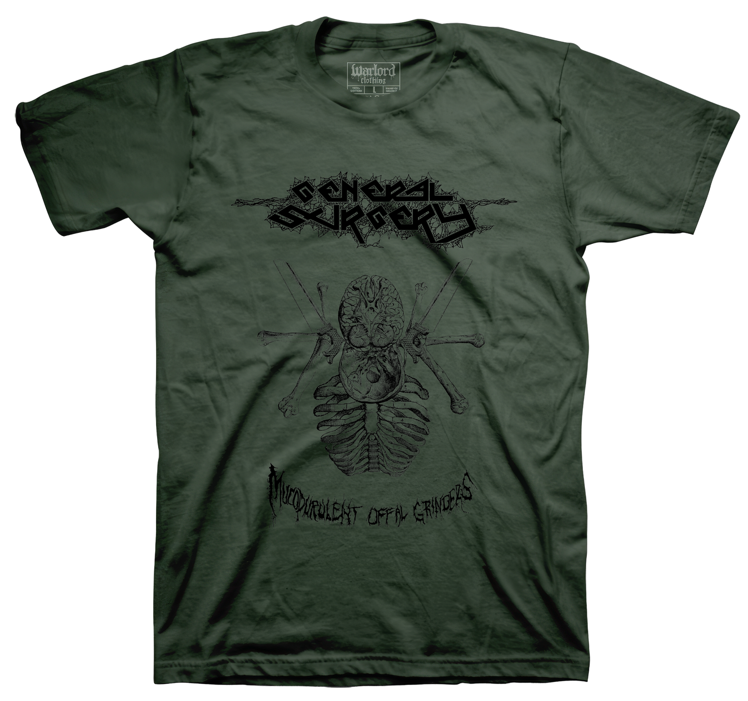 General Surgery - Olive