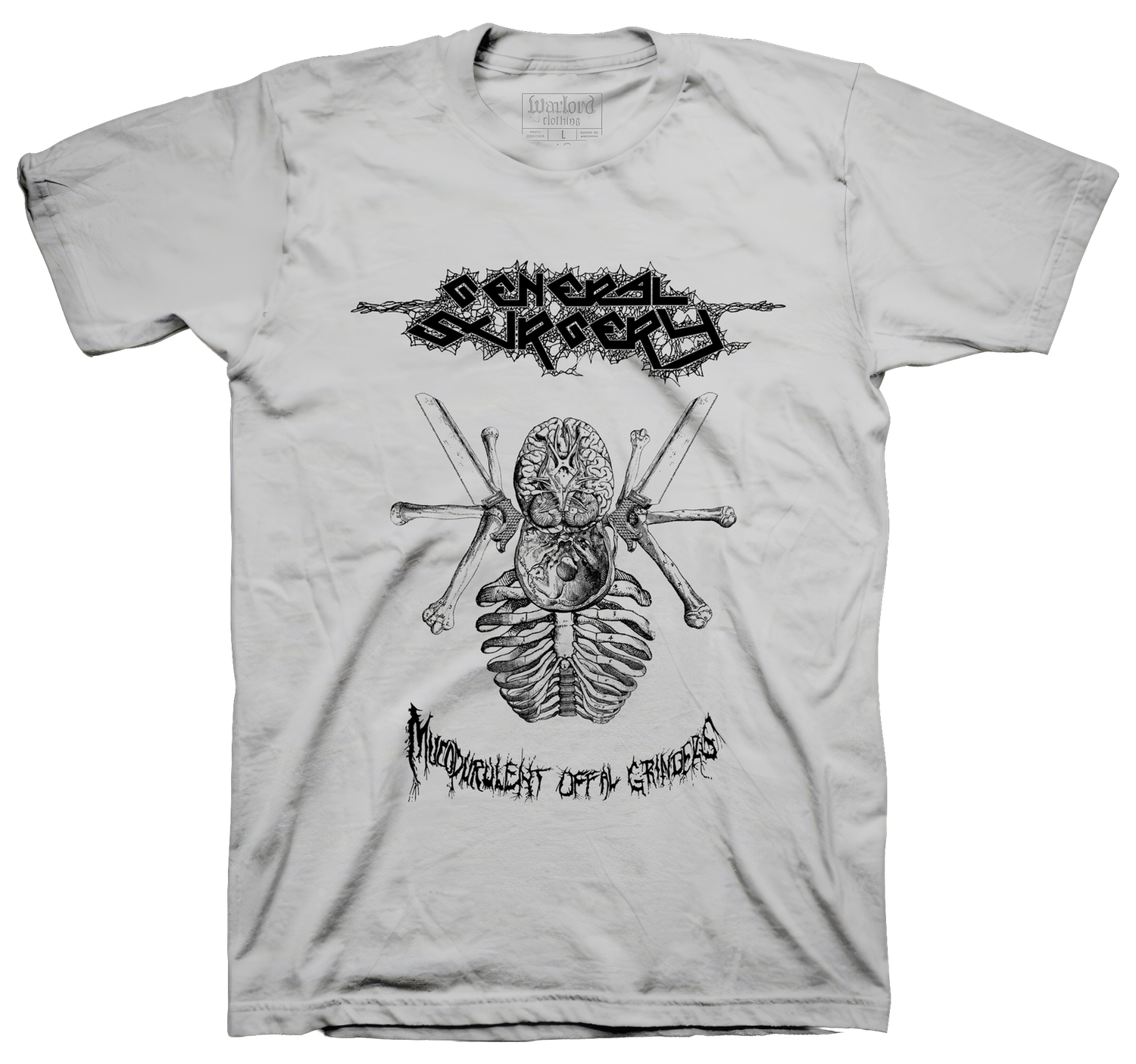General Surgery - Silver