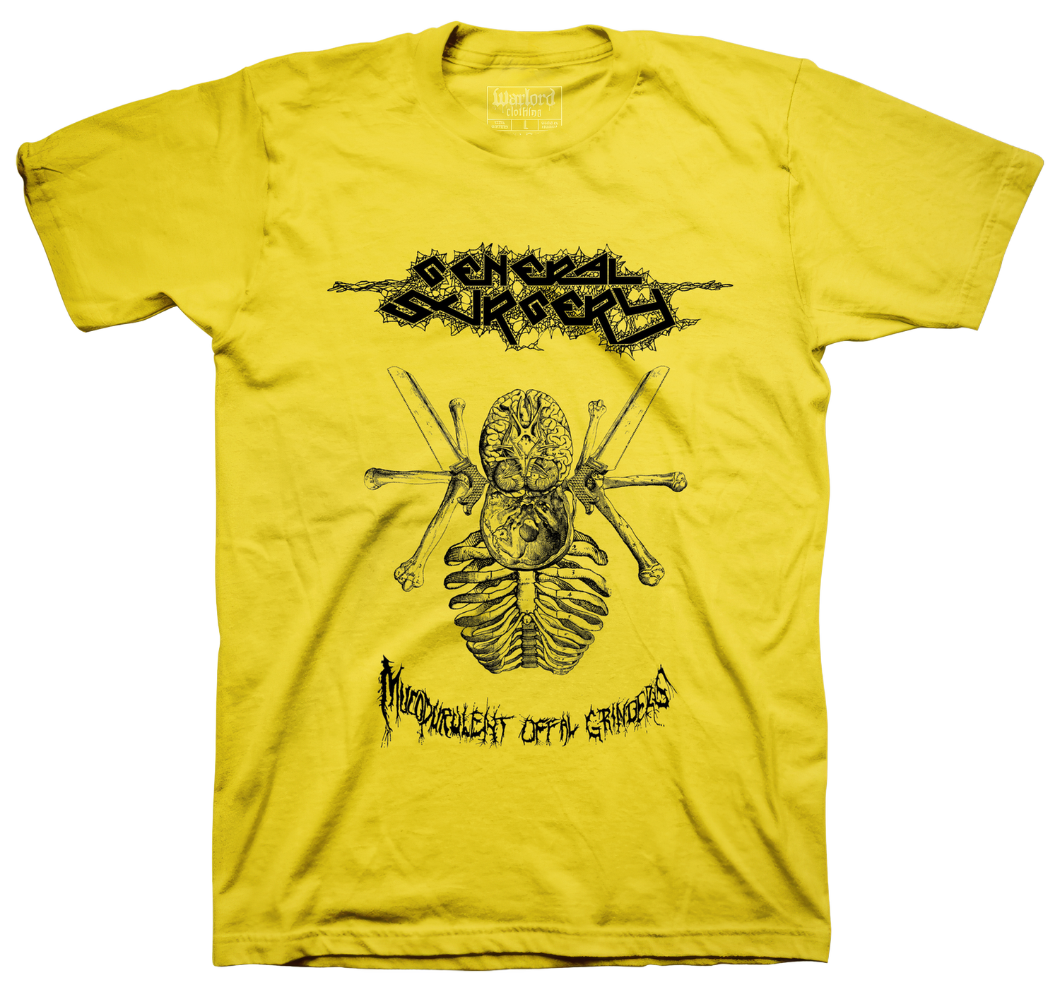 General Surgery - Yellow