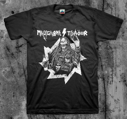 Malignant Tumor